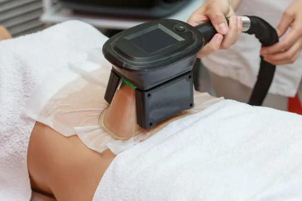 Image of person having fat freezing treatment to help weight gain Inverness