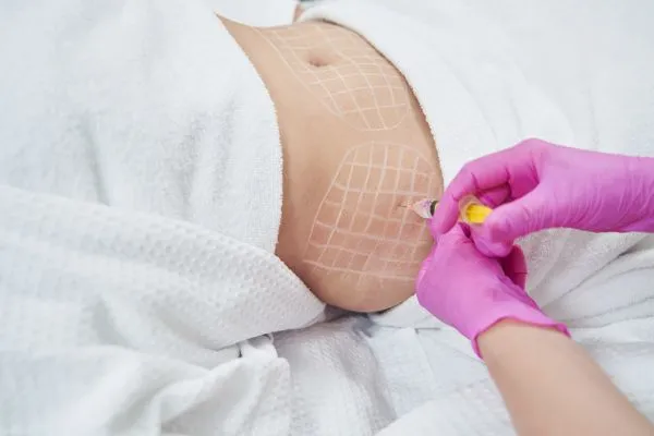image of fat dissolving injections on love handles to help combat weight gain Inverness
